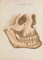 Picture 1 of 3 from Chart of typical forms of constitutional irregularities of the teeth (1891), leaf 23