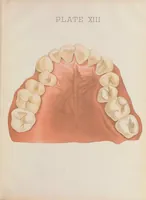 An illustration from Chart of typical forms of constitutional irregularities of the teeth (1891)