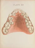 An illustration from Chart of typical forms of constitutional irregularities of the teeth (1891)