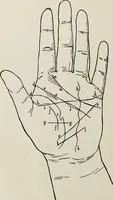 An illustration from Cheiro's language of the hand : complete practical work on the sciences of cheirognomy and cheiromancy, containing the system, rules, and experience of Cheiro [pseud.] fifty-five full-page illustrations, and over two hundred engravings of lines, mounts, and marks (1900)