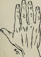 An illustration from Cheiro's language of the hand : complete practical work on the sciences of cheirognomy and cheiromancy, containing the system, rules, and experience of Cheiro [pseud.] fifty-five full-page illustrations, and over two hundred engravings of lines, mounts, and marks (1900)