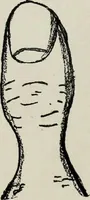 Picture 9 of 56 from Cheiro's language of the hand : complete practical work on the sciences of cheirognomy and cheiromancy, containing the system, rules, and experience of Cheiro [pseud.] fifty-five full-page illustrations, and over two hundred engravings of lines, mounts, and marks (1900), leaf 79
