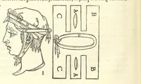 An illustration from Chirurgia (1544)