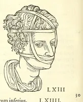 An illustration from Chirurgia (1544)