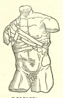 An illustration from Chirurgia (1544)