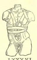 An illustration from Chirurgia (1544)
