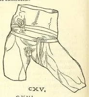 An illustration from Chirurgia (1544)