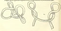 An illustration from Chirurgia (1544)