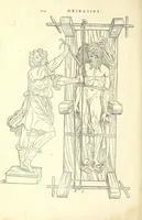 An illustration from Chirurgia (1544)