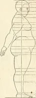 An illustration from Clariss[imi] pictoris et geometræ Alberti Dureri, De varietate figurarum et flexuris partium ac gestib[um] imaginum, : libri duo, cqui priorib[us] De symmetria quondam editis, nunc primum in latinum conversi accesserunt (1534)