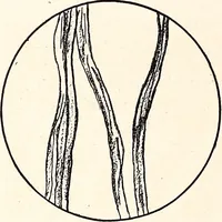 An illustration from Clothing and health (1916)