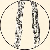 An illustration from Clothing and health (1916)