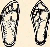An illustration from Clothing and health (1916)