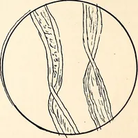 An illustration from Clothing and health (1916)