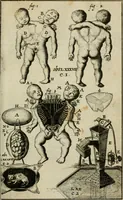 An illustration from Collectanea medico-physica, oft, Hollands jaar-register der genees- en natuur-kundige aanmerkingen van gantsch Europa &c. : beginnende met het jaar MDCLXXX : door eigen ondervinding en gemeen-making van verscheide heeren en liefhebbers (1680)