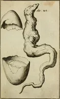 An illustration from Collectanea medico-physica, oft, Hollands jaar-register der genees- en natuur-kundige aanmerkingen van gantsch Europa &c. : beginnende met het jaar MDCLXXX : door eigen ondervinding en gemeen-making van verscheide heeren en liefhebbers (1680)