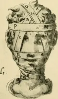 Picture 74 of 195 from Collection de chirurgiens grecs avec dessins attribués au Primatice. Reproduction réduite des 200 dessins du Manuscrit latin 6866 de la Bibliothèque nationale (1908), leaf 100