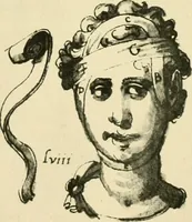 Picture 80 of 195 from Collection de chirurgiens grecs avec dessins attribués au Primatice. Reproduction réduite des 200 dessins du Manuscrit latin 6866 de la Bibliothèque nationale (1908), leaf 104
