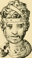 An illustration from Collection de chirurgiens grecs avec dessins attribués au Primatice. Reproduction réduite des 200 dessins du Manuscrit latin 6866 de la Bibliothèque nationale (1908)