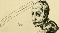 Picture 89 of 195 from Collection de chirurgiens grecs avec dessins attribués au Primatice. Reproduction réduite des 200 dessins du Manuscrit latin 6866 de la Bibliothèque nationale (1908), leaf 110