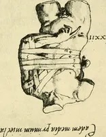 Picture 91 of 195 from Collection de chirurgiens grecs avec dessins attribués au Primatice. Reproduction réduite des 200 dessins du Manuscrit latin 6866 de la Bibliothèque nationale (1908), leaf 112