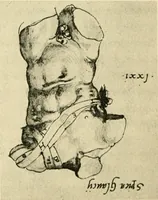 Picture 92 of 195 from Collection de chirurgiens grecs avec dessins attribués au Primatice. Reproduction réduite des 200 dessins du Manuscrit latin 6866 de la Bibliothèque nationale (1908), leaf 112