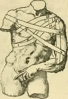 Picture 94 of 195 from Collection de chirurgiens grecs avec dessins attribués au Primatice. Reproduction réduite des 200 dessins du Manuscrit latin 6866 de la Bibliothèque nationale (1908), leaf 114