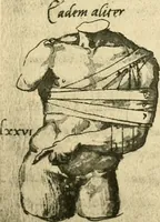 Picture 95 of 195 from Collection de chirurgiens grecs avec dessins attribués au Primatice. Reproduction réduite des 200 dessins du Manuscrit latin 6866 de la Bibliothèque nationale (1908), leaf 114