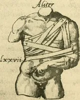 Picture 96 of 195 from Collection de chirurgiens grecs avec dessins attribués au Primatice. Reproduction réduite des 200 dessins du Manuscrit latin 6866 de la Bibliothèque nationale (1908), leaf 114