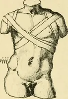 Picture 97 of 195 from Collection de chirurgiens grecs avec dessins attribués au Primatice. Reproduction réduite des 200 dessins du Manuscrit latin 6866 de la Bibliothèque nationale (1908), leaf 116
