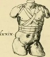 Picture 98 of 195 from Collection de chirurgiens grecs avec dessins attribués au Primatice. Reproduction réduite des 200 dessins du Manuscrit latin 6866 de la Bibliothèque nationale (1908), leaf 116