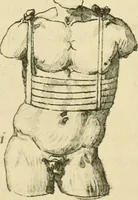 Picture 100 of 195 from Collection de chirurgiens grecs avec dessins attribués au Primatice. Reproduction réduite des 200 dessins du Manuscrit latin 6866 de la Bibliothèque nationale (1908), leaf 116