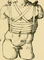 An illustration from Collection de chirurgiens grecs avec dessins attribués au Primatice. Reproduction réduite des 200 dessins du Manuscrit latin 6866 de la Bibliothèque nationale (1908)