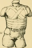 Picture 102 of 195 from Collection de chirurgiens grecs avec dessins attribués au Primatice. Reproduction réduite des 200 dessins du Manuscrit latin 6866 de la Bibliothèque nationale (1908), leaf 118