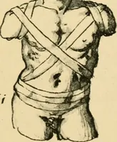 Picture 103 of 195 from Collection de chirurgiens grecs avec dessins attribués au Primatice. Reproduction réduite des 200 dessins du Manuscrit latin 6866 de la Bibliothèque nationale (1908), leaf 118