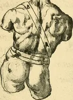 Picture 107 of 195 from Collection de chirurgiens grecs avec dessins attribués au Primatice. Reproduction réduite des 200 dessins du Manuscrit latin 6866 de la Bibliothèque nationale (1908), leaf 122