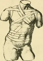 Picture 111 of 195 from Collection de chirurgiens grecs avec dessins attribués au Primatice. Reproduction réduite des 200 dessins du Manuscrit latin 6866 de la Bibliothèque nationale (1908), leaf 124