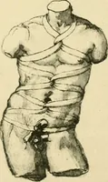 Picture 113 of 195 from Collection de chirurgiens grecs avec dessins attribués au Primatice. Reproduction réduite des 200 dessins du Manuscrit latin 6866 de la Bibliothèque nationale (1908), leaf 124