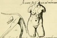 Picture 114 of 195 from Collection de chirurgiens grecs avec dessins attribués au Primatice. Reproduction réduite des 200 dessins du Manuscrit latin 6866 de la Bibliothèque nationale (1908), leaf 126