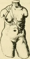 Picture 115 of 195 from Collection de chirurgiens grecs avec dessins attribués au Primatice. Reproduction réduite des 200 dessins du Manuscrit latin 6866 de la Bibliothèque nationale (1908), leaf 126