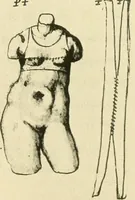 Picture 116 of 195 from Collection de chirurgiens grecs avec dessins attribués au Primatice. Reproduction réduite des 200 dessins du Manuscrit latin 6866 de la Bibliothèque nationale (1908), leaf 126