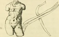Picture 117 of 195 from Collection de chirurgiens grecs avec dessins attribués au Primatice. Reproduction réduite des 200 dessins du Manuscrit latin 6866 de la Bibliothèque nationale (1908), leaf 128