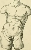 Picture 119 of 195 from Collection de chirurgiens grecs avec dessins attribués au Primatice. Reproduction réduite des 200 dessins du Manuscrit latin 6866 de la Bibliothèque nationale (1908), leaf 128