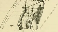 Picture 123 of 195 from Collection de chirurgiens grecs avec dessins attribués au Primatice. Reproduction réduite des 200 dessins du Manuscrit latin 6866 de la Bibliothèque nationale (1908), leaf 132