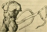Picture 125 of 195 from Collection de chirurgiens grecs avec dessins attribués au Primatice. Reproduction réduite des 200 dessins du Manuscrit latin 6866 de la Bibliothèque nationale (1908), leaf 134