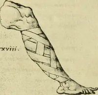 Picture 134 of 195 from Collection de chirurgiens grecs avec dessins attribués au Primatice. Reproduction réduite des 200 dessins du Manuscrit latin 6866 de la Bibliothèque nationale (1908), leaf 142