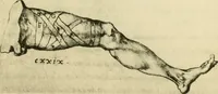 Picture 135 of 195 from Collection de chirurgiens grecs avec dessins attribués au Primatice. Reproduction réduite des 200 dessins du Manuscrit latin 6866 de la Bibliothèque nationale (1908), leaf 142