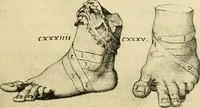Picture 137 of 195 from Collection de chirurgiens grecs avec dessins attribués au Primatice. Reproduction réduite des 200 dessins du Manuscrit latin 6866 de la Bibliothèque nationale (1908), leaf 144