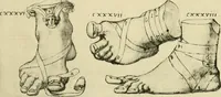 Picture 138 of 195 from Collection de chirurgiens grecs avec dessins attribués au Primatice. Reproduction réduite des 200 dessins du Manuscrit latin 6866 de la Bibliothèque nationale (1908), leaf 146