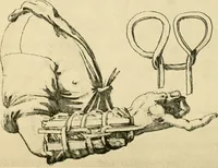 An illustration from Collection de chirurgiens grecs avec dessins attribués au Primatice. Reproduction réduite des 200 dessins du Manuscrit latin 6866 de la Bibliothèque nationale (1908)